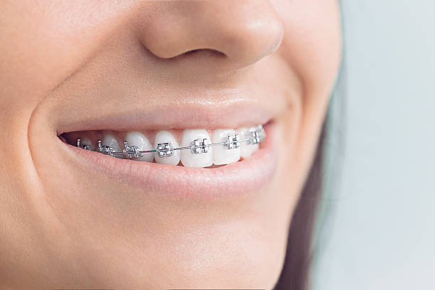 Best Dental Bonding  in Goodman, MO